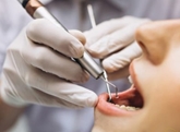یک کارشناس بهداشت: سلامت دهان و دندان مادر، ضامن سلامت جنین و پیشگیری از زایمان زودرس است